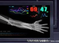 为啥佐助不让纲手给自己上义肢？原来断臂会更强！